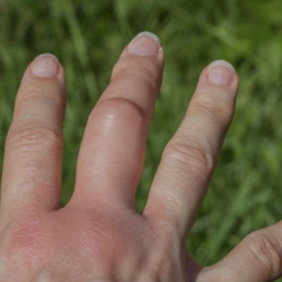 QUOD ME NON OCCİDİT FORTİOR ME/ Beni Öldürmeyen Her&nbsp;Şey